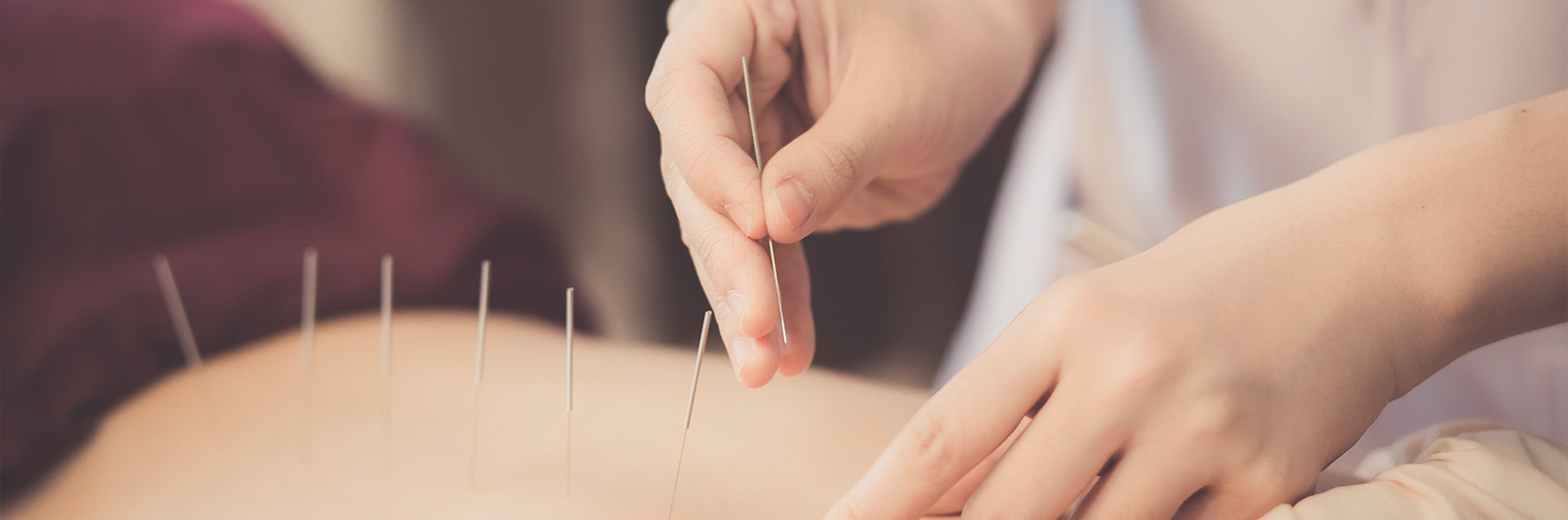 a person receiving acupuncture