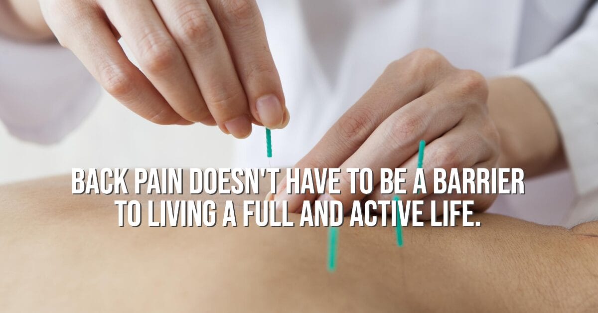 Acupuncture for back pain image
