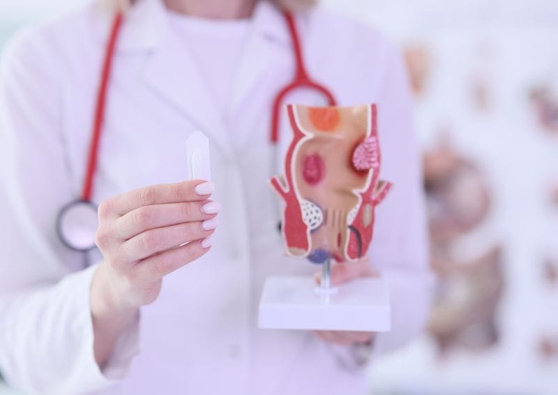 Doctor holding Hemorrhoids image